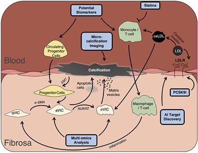 Heart Valve Disease: Challenges and New Opportunities